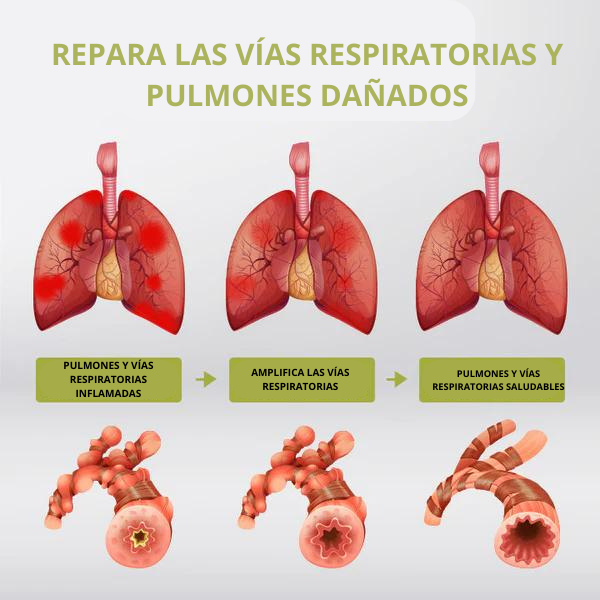 Alergia Xtrem - Dile adios a las alergias🍃